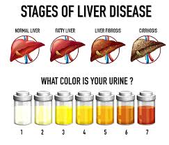 understanding liver function tests