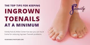 preventing ingrown toenails family