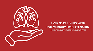 State of the art chronic thromboembolic pulmonary hypertension    