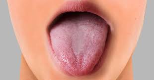 top treatment for painful tongue ps
