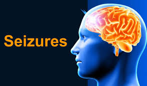 seizures types causes symptoms