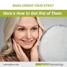 bags under your eyes here s how to get