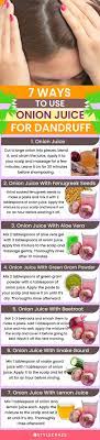 how can onion juice help reduce dandruff