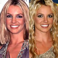 Resultado de imagem para antes e depois dos famosos
