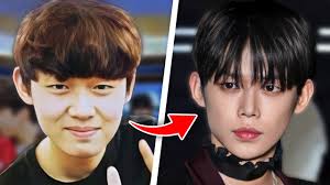 14 k pop idols before and after plastic