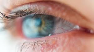 ocular herpes symptoms and treatments