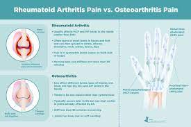 Rheumatoid Arthritis Joint Pain Vs Osteoarthritis Joint Pain gambar png