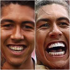 Jurgen klopp has been all smiles with liverpool in the champions league final. Anfield Hub On Twitter Roberto Firmino S Teeth Are A Visual Representation Of How Bright Our Future Was And Now Is After Jurgen Klopp Took Over Https T Co Nkgrxcvwks