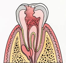 Maybe you would like to learn more about one of these? How To Get Rid Of A Toothache The Comprehensive Guide Uk