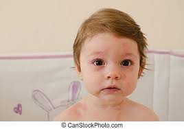 Roseola is spread through contact or even sharing the same room with the infected person as the take plenty of rest. Roseola Infantum Baby Girl Body Covered With Roseola Skin Rash Sixth Disease Canstock