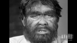 Scientist Transforms Into Ape - The Neanderthal Man (1953) - YouTube