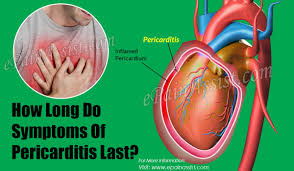 Learn about pericardial disease and its causes, symptoms and treatment. How Long Do Symptoms Of Pericarditis Last
