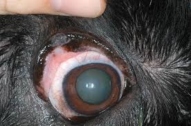 eyelid tumors