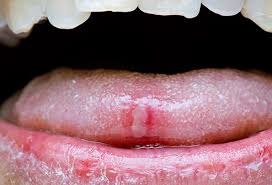 Pictures What Your Tongue Says About Your Health