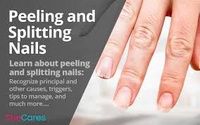 splitting and ling nails shecares