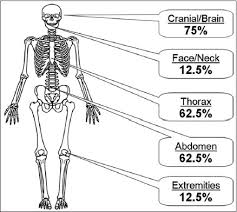 Fractures Of The Occipital Condyle Clinical Spectrum And