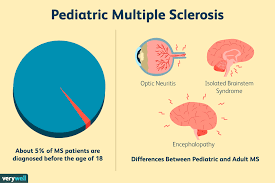 Pediatric Multiple Sclerosis Symptoms Diagnosis And More