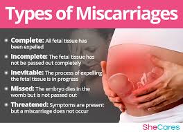 miscarriage shecares