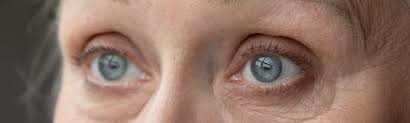 watery eyes in the elderly causes