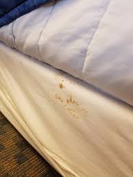 Stains On Box Spring Cover Picture Of