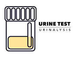 Urine Test Urinalysis American Pregnancy Association