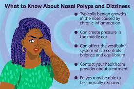 why can nasal polyps make you dizzy
