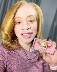 black albino in the beauty business