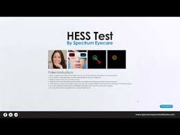Clinical Tutorial Hess Eom Test Youtube