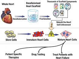 Stem Cells Used To Treat Heart Disease gambar png