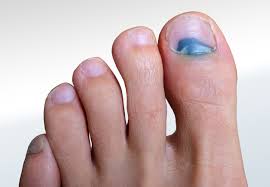 toenail conditions relieve foot pain