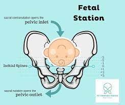 the pelvis for labor and birth