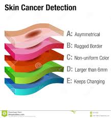 Skin Cancer Chart Stock Illustrations 11 Skin Cancer Chart