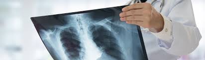 Check spelling or type a new query. 4 Situations That Require A Chest X Ray And What To Expect Gohealth Urgent Care