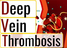 Dvt Deep Vein Thrombosis Nclex Questions
