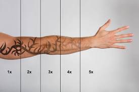 Tattoo scabbing on your first piece of ink can be very worrying if you're not sure of the whole tattoo healing process. The Healing Process What To Expect After Tattoo Removal In Nyc