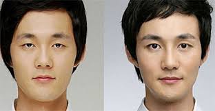 korean k pop plastic surgery for