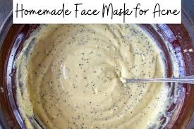 homemade face mask for acne 20 natural