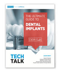 The Ultimate Guide To Dental Implants Published