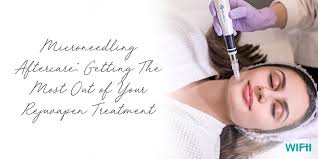 If you are really shedding that badly i would follow up with the person who performed your treatment and let. Microneedling Aftercare Get The Most Out Of Your Treatment
