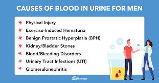 blood in urine for men hematuria