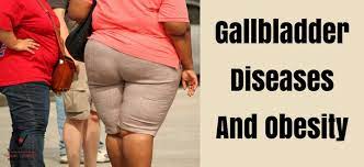 gallbladder diseases and obesity what