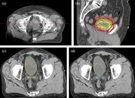 cone beam ct imaging ysis of