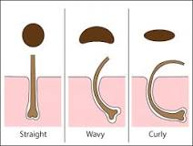 what-affects-hair-follicle-shape