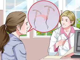 how to get an iud taken out