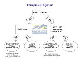 The Endo Blog Pulpal Periapical Diagnosis