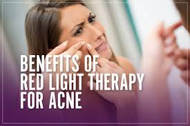 What Are The Benefits Of Red Light Therapy For Acne Uncovered