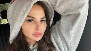 Zuzana placková on wn network delivers the latest videos and editable pages for news & events, including entertainment, music, sports, science and more, sign up and share your playlists. Forget About Enlarged Lips And Artificial Hair Zuzka Plackova Has A Good Reason To Change
