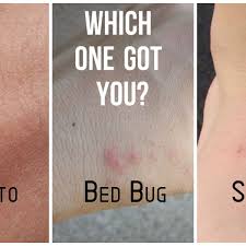 Bite mark, sting or sore on human skin. Bed Bug And Mosquito Bite Comparisons Youmemindbody Health Wellness