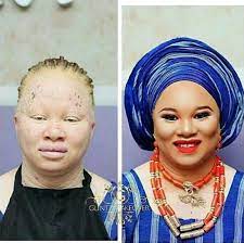 albino lady s makeup transformation