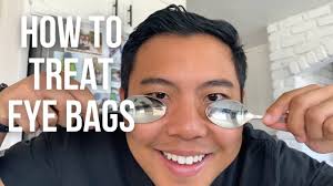 how to get rid of under eye bags fast